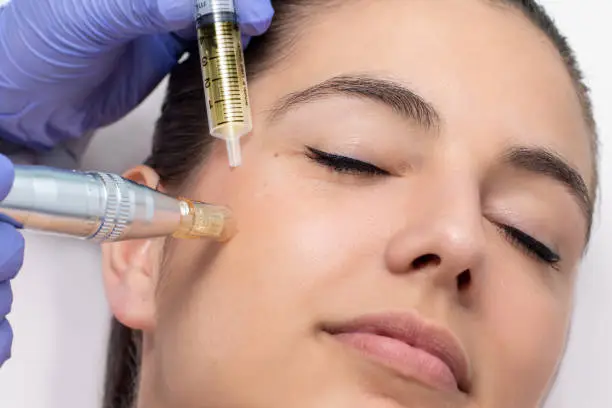 Permanent BB Glow Therapy